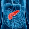 radiografía de la pancreatitis aguda